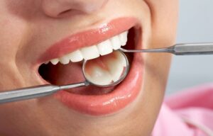 What is a dental restoration?