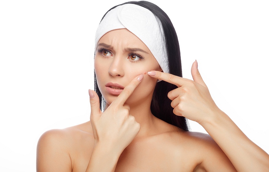 Preventing Acne: Tips for Maintaining Clear, Healthy Skin